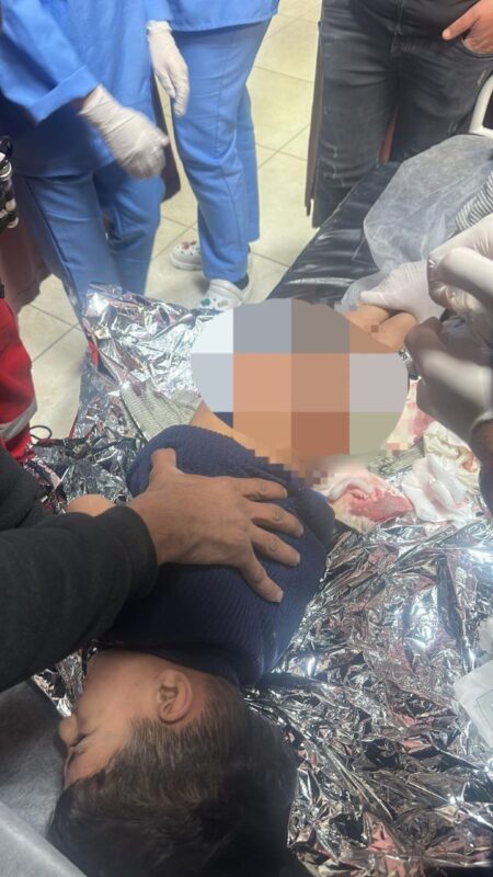 إصابات برصاص الاحتلال وطفل برضوض خلال اقتحام قوات خاصة مخيم بلاطة