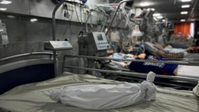 استشهاد 4 مواطنين بينهم طفلان بسبب المجاعة ما يرفع الحصيلة إلى 34