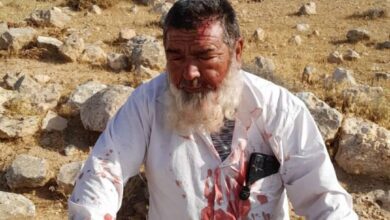 مستوطنون يعتدون بالضرب على مواطن في مسافر يطا جنوب الخليل
