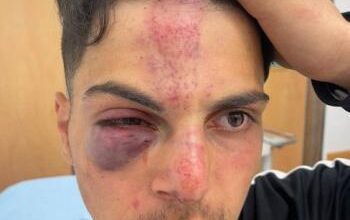 مستوطنون يعتدون على شاب في القدس المحتلة