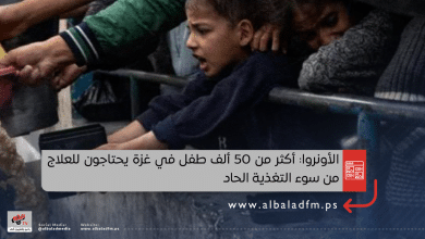 الأونروا: أكثر من 50 ألف طفل في غزة يحتاجون للعلاج من سوء التغذية الحاد