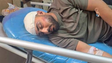 إصابة شاب باعتداء جنود الاحتلال في العوجا