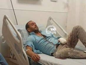 عقب الاعتداء عليه بوحشية: الاحتلال يبتر إصبعين لشاب من دير أبو مشعل