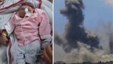 ولادة طفلة "بلا دماغ" شمال غزة.. تصاعد حالات تشوّه الأجنة بفعل الأسلحة التي يستخدمها الاحتلال.