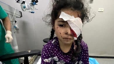 صحة غزة: 1500 مواطن فقدوا البصر جراء حرب الإبادة و4000 مهددون بفقدانه