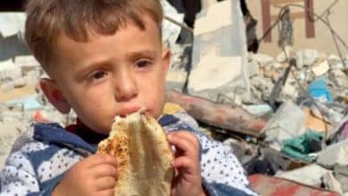 الأونروا: أكثر من 2700 طفل في غزة أصيبوا بسوء تغذية حاد