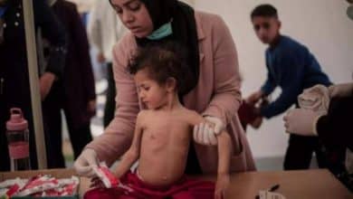 حماس: أكثر من 66 طفلاً في قطاع غزة فقدوا حياتهم بسبب سوء التغذية