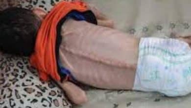 استشهاد طفلة نتيجة سوء التغذية وسط القطاع