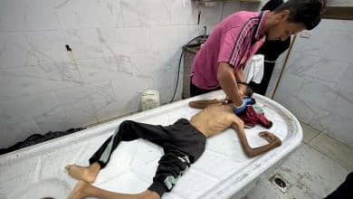 لترتفع الحصيلة إلى 25 منذ الأحد: وفاة طفلين شمال وجنوب قطاع غزة بسبب سوء التغذية والمجاعة