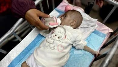 67 طفلا في غزة استشهدوا بسبب سوء التغذية وأكثر من 650 ألفا في خطر مباشر