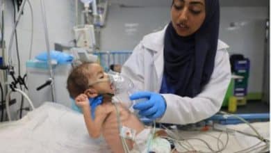 "المنظمات الأهلية": 900 ألف طفل يقاسون سوء التغذية في غزة