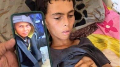 استشهاد الفتى عاطف أبو خاطر بسبب سوء التغذية والمجاعة في غزة