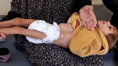 الأمم المتحدة: سوء التغذية الحاد بين الأطفال بغزة وصل أعلى مستوى
