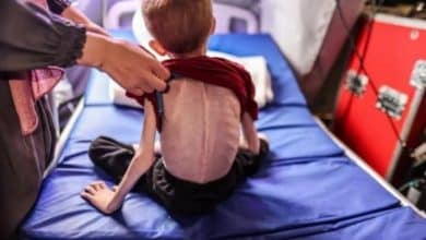 ارتفاع شهداء التجويع في غزة الى 251 بينهم 108 أطفال
