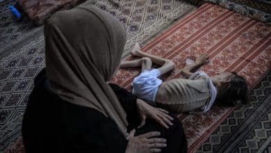 وفاتان نتيجة المجاعة وسوء التغذية خلال الـ24 ساعة الماضية