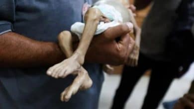 3 وفيات نتيجة التجويع وسوء التغذية في غزة خلال الـ24 ساعة الماضية