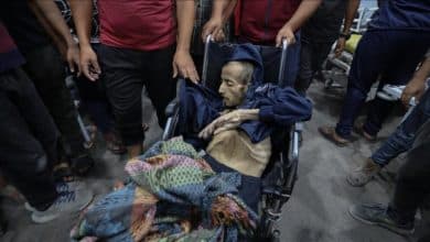 7 وفيات بينهم طفلان في غزة نتيجة المجاعة وسوء التغذية خلال الـ24 ساعة الماضية