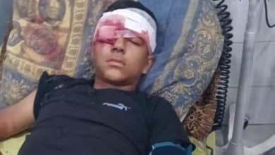 إصابة طفل بجروح خطيرة بقنبلة صوت أطلقها جنود الاحتلال صوب رأسه في بلدة بيت عوا جنوب غرب الخليل