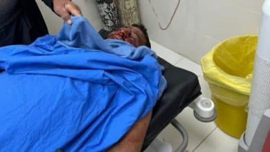 استشهاد أمير محمد شناران وإصابة شقيقه خالد بجروح حرجة برصاص مستوطنين في مسافر يطا