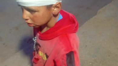 إصابة طفل باعتداء للمستوطنين في خلايل اللوز ببيت لحم