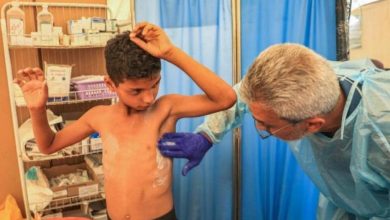 الأمم المتحدة تُحذر من تفشٍ واسع لـ "جدري الماء" في قطاع غزة